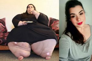 A transformação incrível de uma mulher que chegou a pesar 300 kg e já perdeu metade do peso