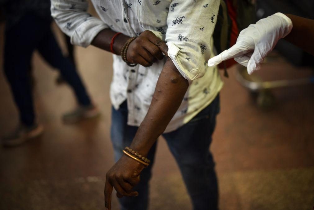 Monkeypox: Comité de Emergência da OMS reunido para avaliar surto com 14 mil casos