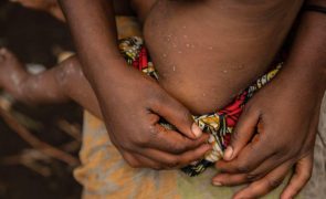 Mais de 22.800 casos e 622 mortes por mpox desde janeiro em 13 países africanos