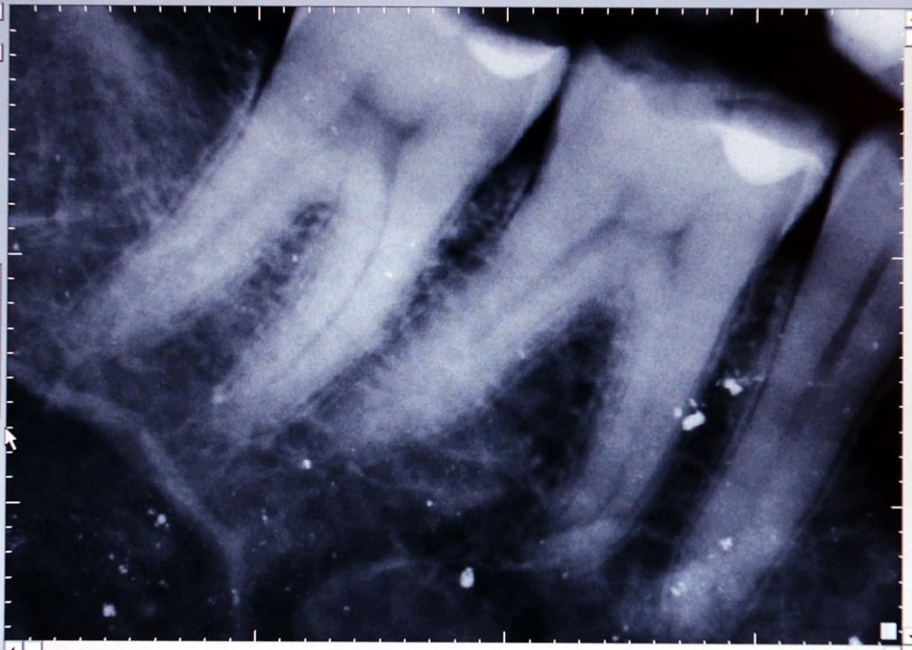 Todos os agrupamentos de centros de saúde vão ter dentistas em 2019