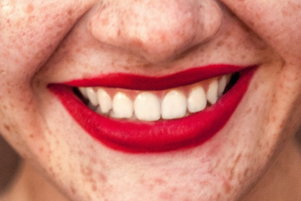 Cuidado com a moda do carvão para branquear os dentes